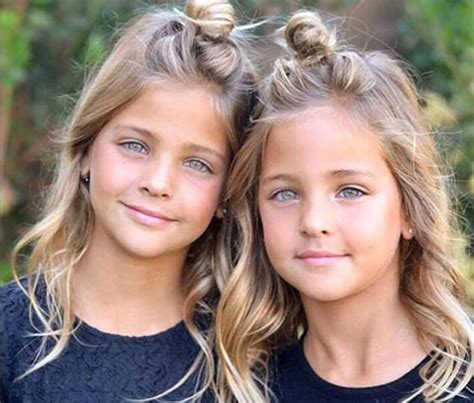 Most Beautiful Twins In The World Birth To 2022