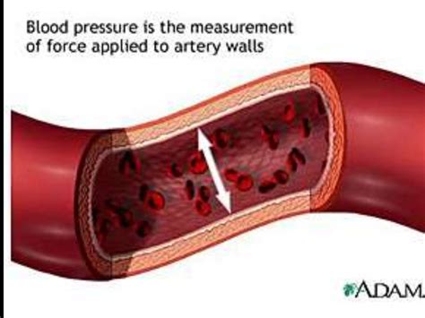 Hypertension Hypertension Types Causes And Management Complications C