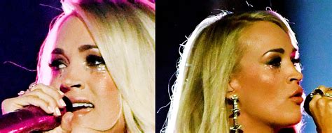 Carrie Underwood New Face Scar Photos From Injury And What Happened