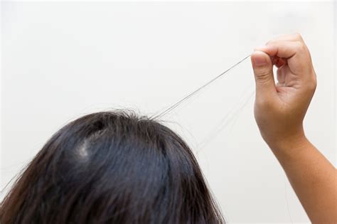 Hair Pulling Disorder Or Trichotillomania In Teenager Women Mental