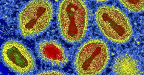 They lack the capacity to how much smaller are most viruses in comparison to bacteria ? Virus de viruela bovina podría ser alternativa contra el ...