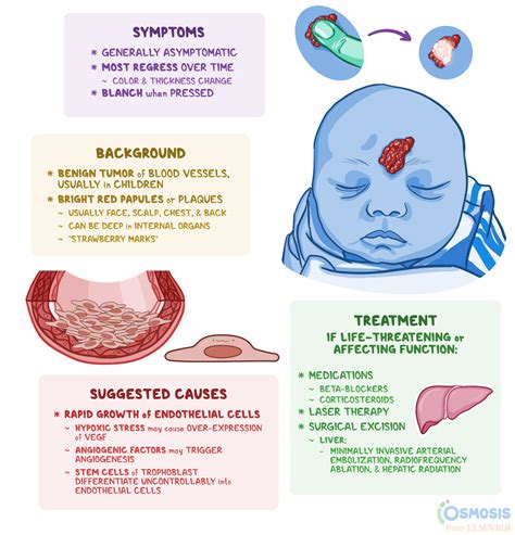 Hemangioma What Is It Signs And Symptoms And More Osmosis