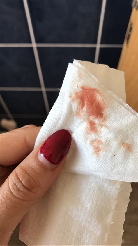 Bleeding 7 Weeks And Your Experience Netmums Chat