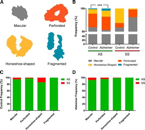 3d Electron Microscopy Study Of Synaptic Organization Of The Normal