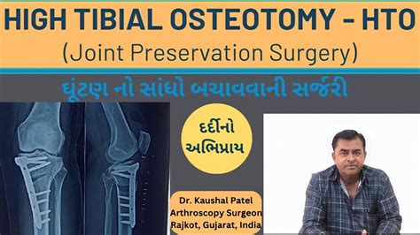 High Tibial Osteotomy Hto Knee Joint Preservation Surgery