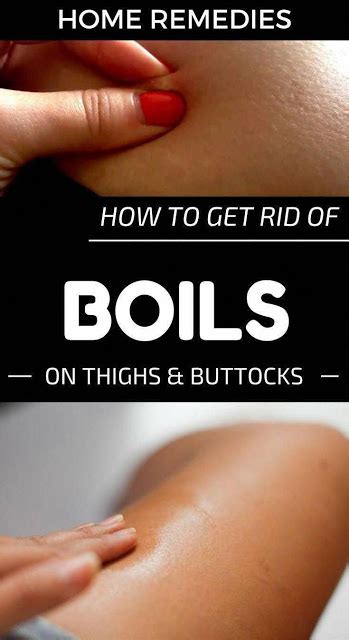 How To Get Rid Of Boils On The Buttocks Healthy Greens
