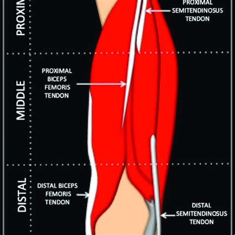A Schematic Diagram Of The Left Hamstring Muscle Divided Into Proximal