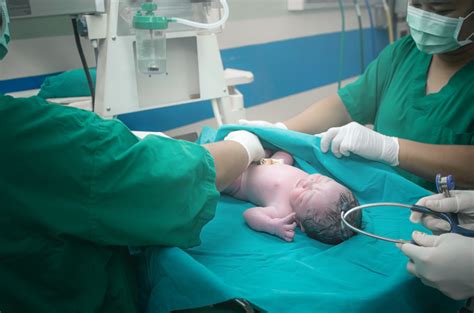 Pemeriksaan Fisik Yang Dilakukan Pada Bayi Baru Lahir