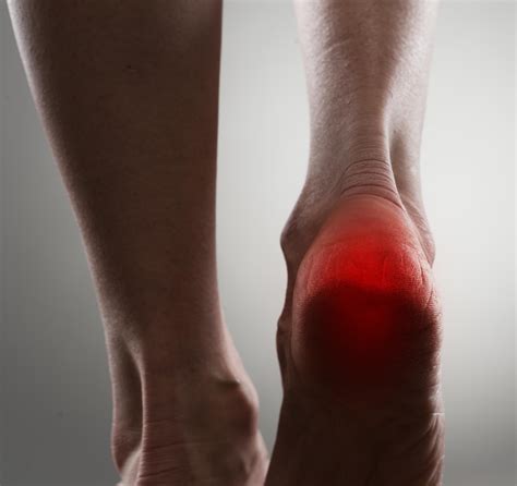 Heel Injuries Heel Disorders Medlineplus