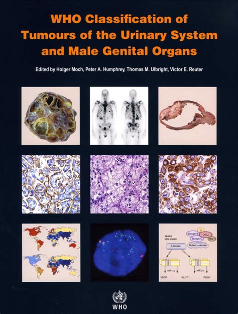 Pathology And Genetics Tumours Of The Urinary System And Male Genital