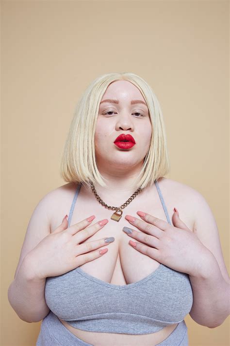 Missguideds New Body Positive Campaign Celebrates Common Skin Imperfections Body Positive
