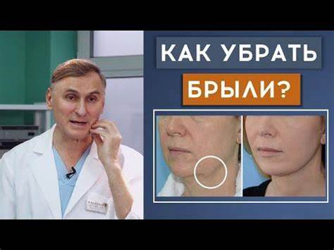 Похудеть чтобы убрать брыли