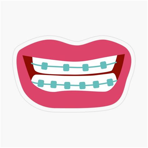 Woman Smiling With Teeth Braces Sticker For Sale By Marufemia Teeth Braces Braces