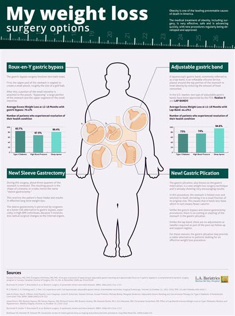Infographic On Weight Loss Surgery Options Marina Weight Loss