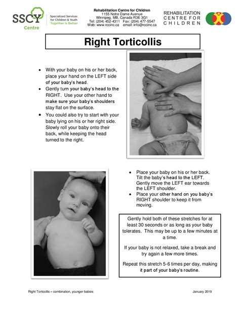 Right Torticollis Combination Younger Babies Rehabilitation Centre