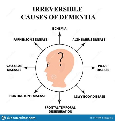 Irreversible Causes of Senile Dementia. Alzheimer`s Disease ...