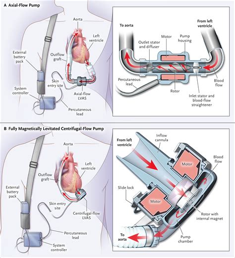 A Fully Magnetically Levitated Circulatory Pump For Advanced Heart