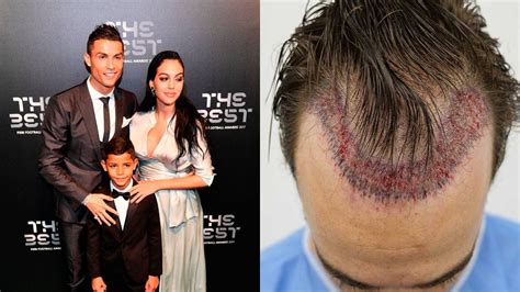 Cristiano Ronaldo To Open A Hair Transplant Centre In Madrid With His