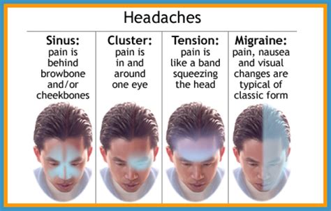 Severe Migraine Headaches
