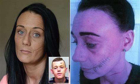 girlfriend left needing more than 20 stitches after her ex partner slashed her face daily mail