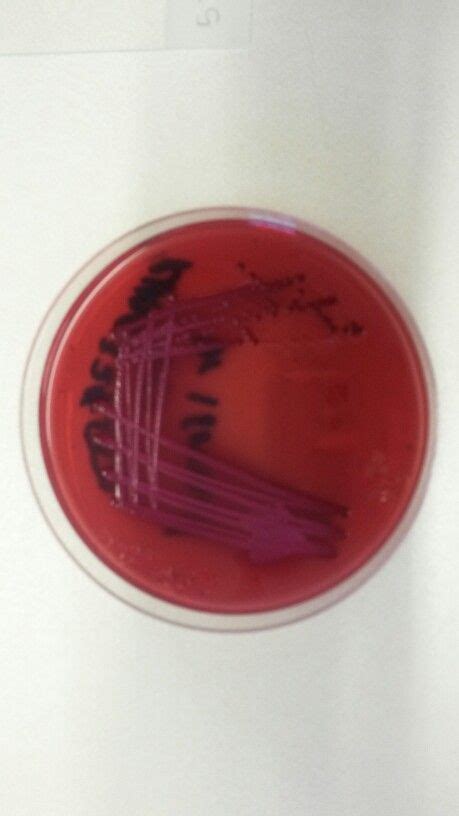 Acinetobacter Baumannii Grown On Blood Agar Microbiology Medical