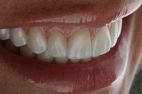 Odontologia Estética Espaço Oral Barra