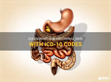 Diagnosing Low Abdominal Pain With Icd 10 Codes Medshun