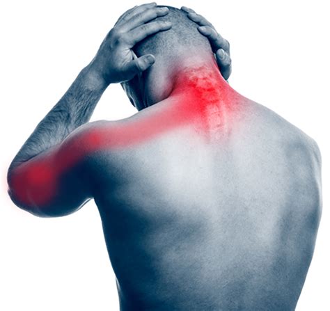 Pinched Nerve In Neck Symptoms Causes Treatment And More Vlrengbr