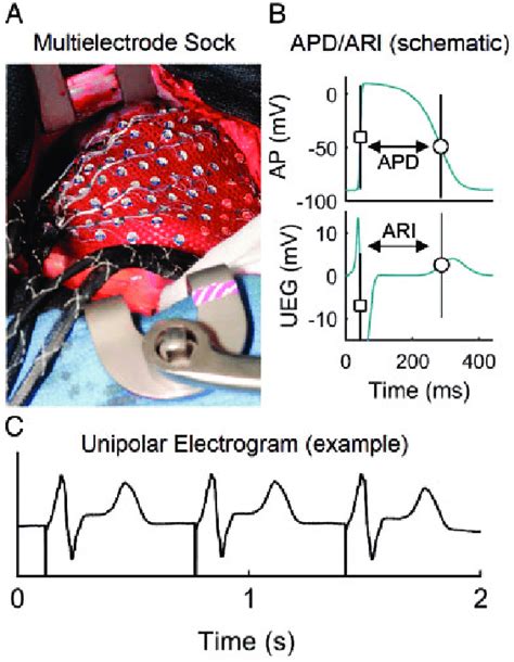 Experimental Set Up A Multi Electrode Sock During Open Heart Surgery