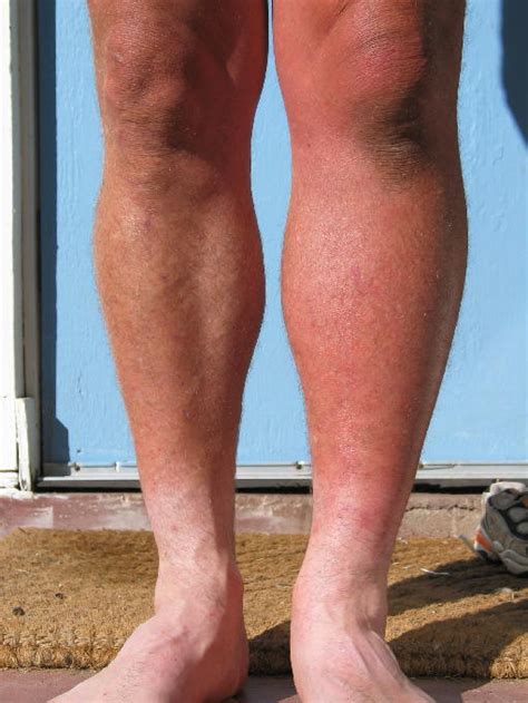 Swelling In Left Leg Causes And Treatments New Health Advisor