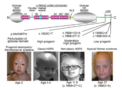 Progeria Cell Mutation