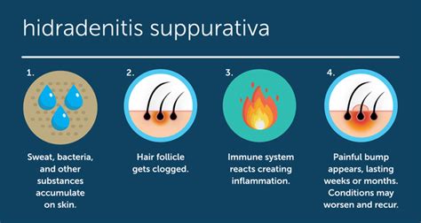 What Is Hidradenitis Suppurativa Hs Advanced Dermatology
