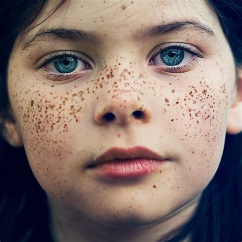 16 Fascinating Photos Of People With Freckles Pictolic