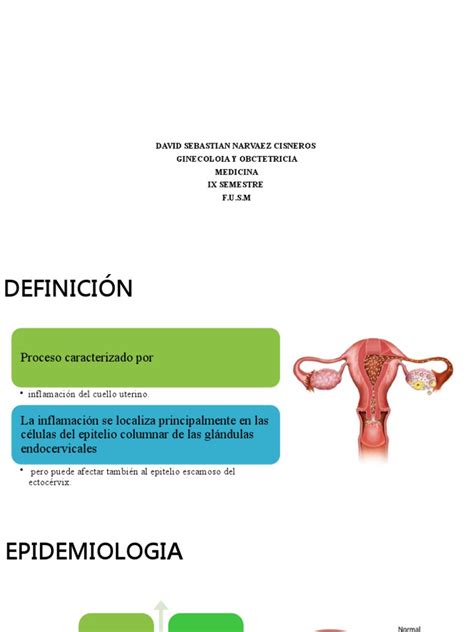 Cervicitis Pdf Inmunología La Salud De La Mujer