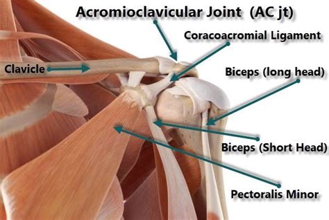 Acromioclavicular Ac Joint Arthritis