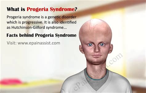 Progeria Syndromefactscausessymptomslife Expectancy