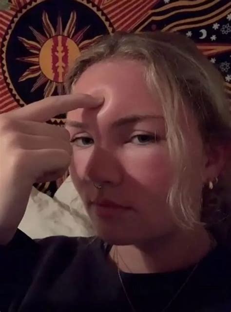 Woman Baffled As She Pokes Her Extremely Swollen Face Leaving A Huge