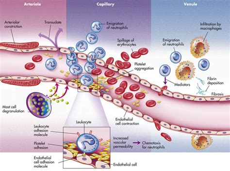 Innate Immunity Inflammation Basicmedical Key