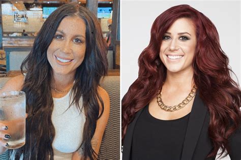 Teen Mom Chelsea Houska Accused Of Getting Chin Implant And Fillers