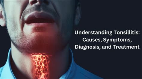 Understanding Tonsillitis Causes Symptoms Diagnosis And Treatment