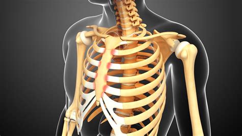 Rheumatoid Arthritis And Costochondritis What To Know About Chest Pain