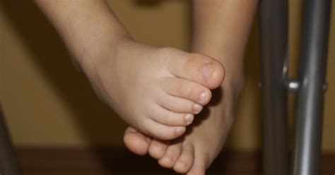 Toddler Foot Problems Livestrongcom