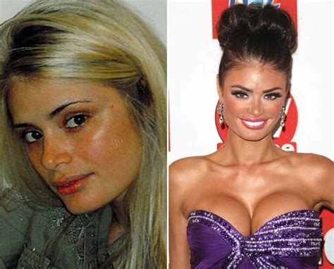Sallie Axl Exposes Michelle Keegans Botox Secrets Daily Star