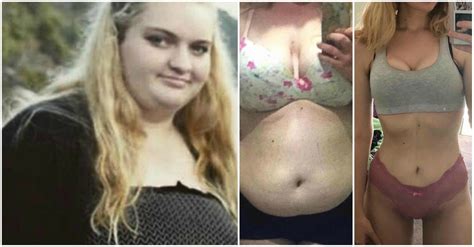 Severely Overweight Teenager Loses Half Her Body Weight In Less Than A
