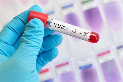 Swine Flu And Diabetes Symptoms Diabetes Risk Prevention And Treatment