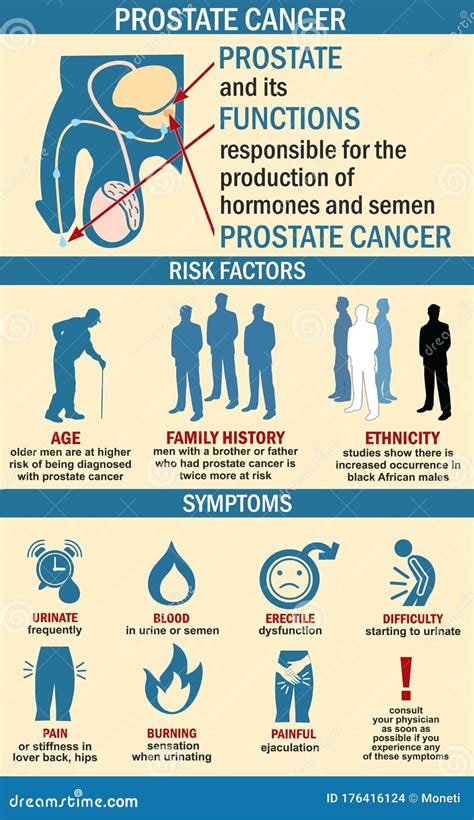 Infographies De L Illustration Du Cancer De La Prostate Sympt Mes Du Cancer De La Prostate
