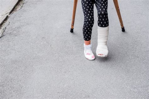 175 Girl Broken Leg Walking Crutches Stock Photos Free And Royalty Free