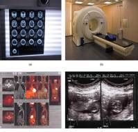 Differences Betweeen X Rays Ct Scans Mri S Medtalks