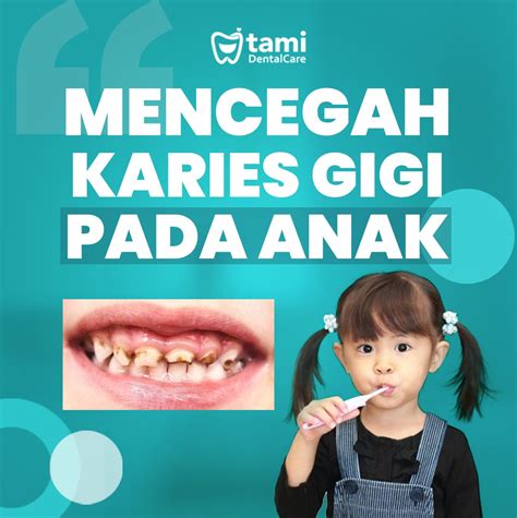 Bagaimana Mencegah Karies Gigi Pada Anak Tami Dental Care Klinik