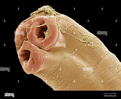 Cobra Tapeworm Coloured Scanning Electron Micrograph Sem Of The Head